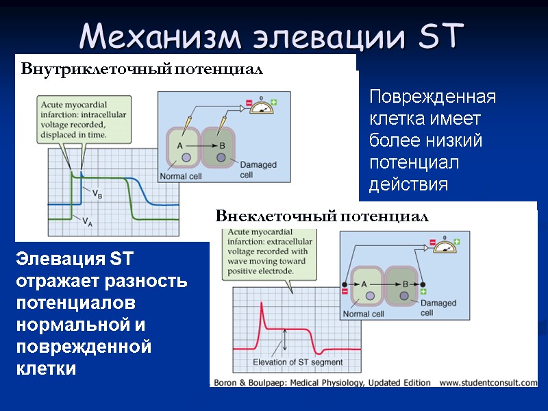 Механизм элевации ST Поврежденная клетка имеет более низкий потенциал действия Элевация ST отражает разность